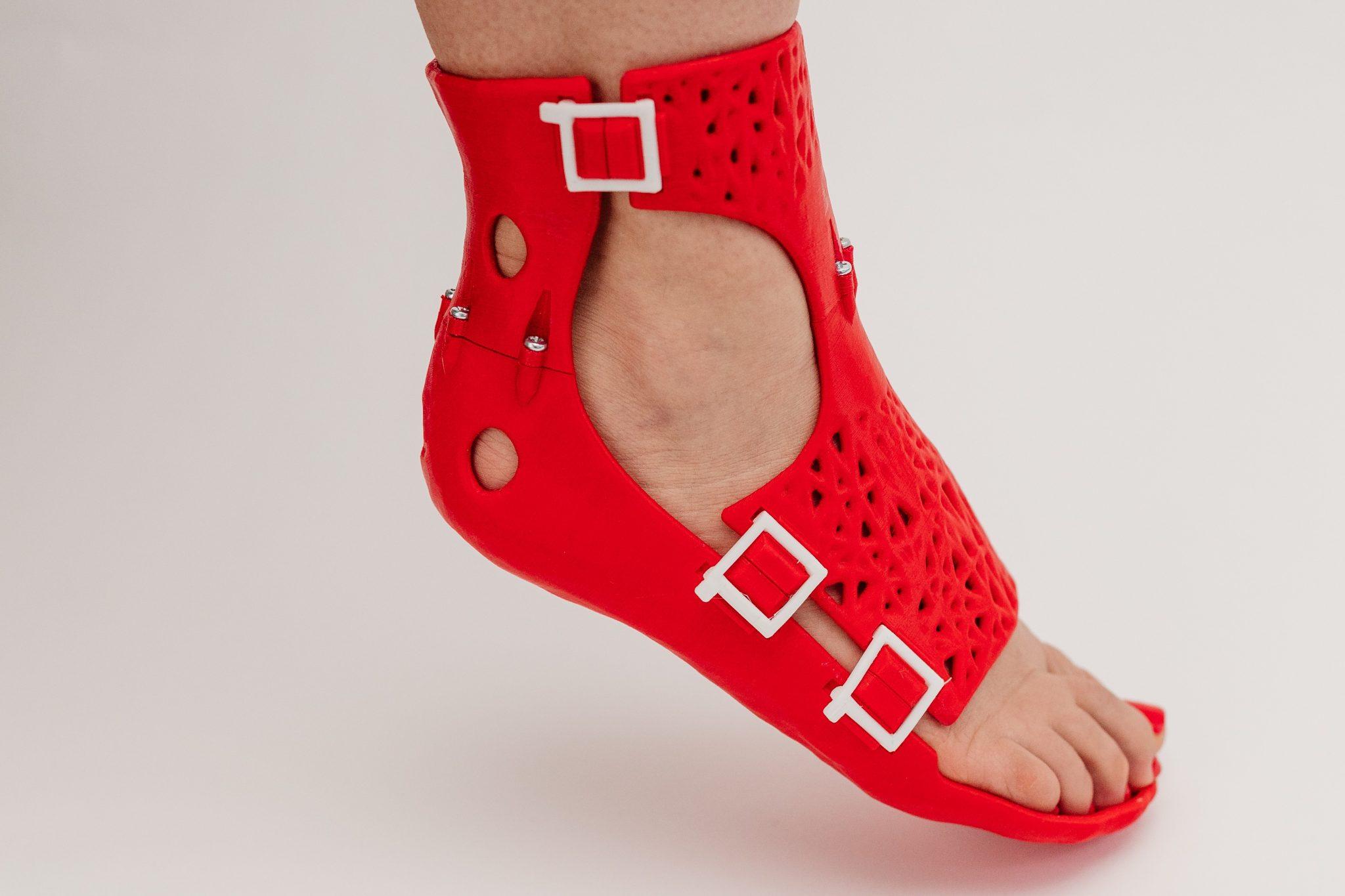 A CastPrint foot brace.