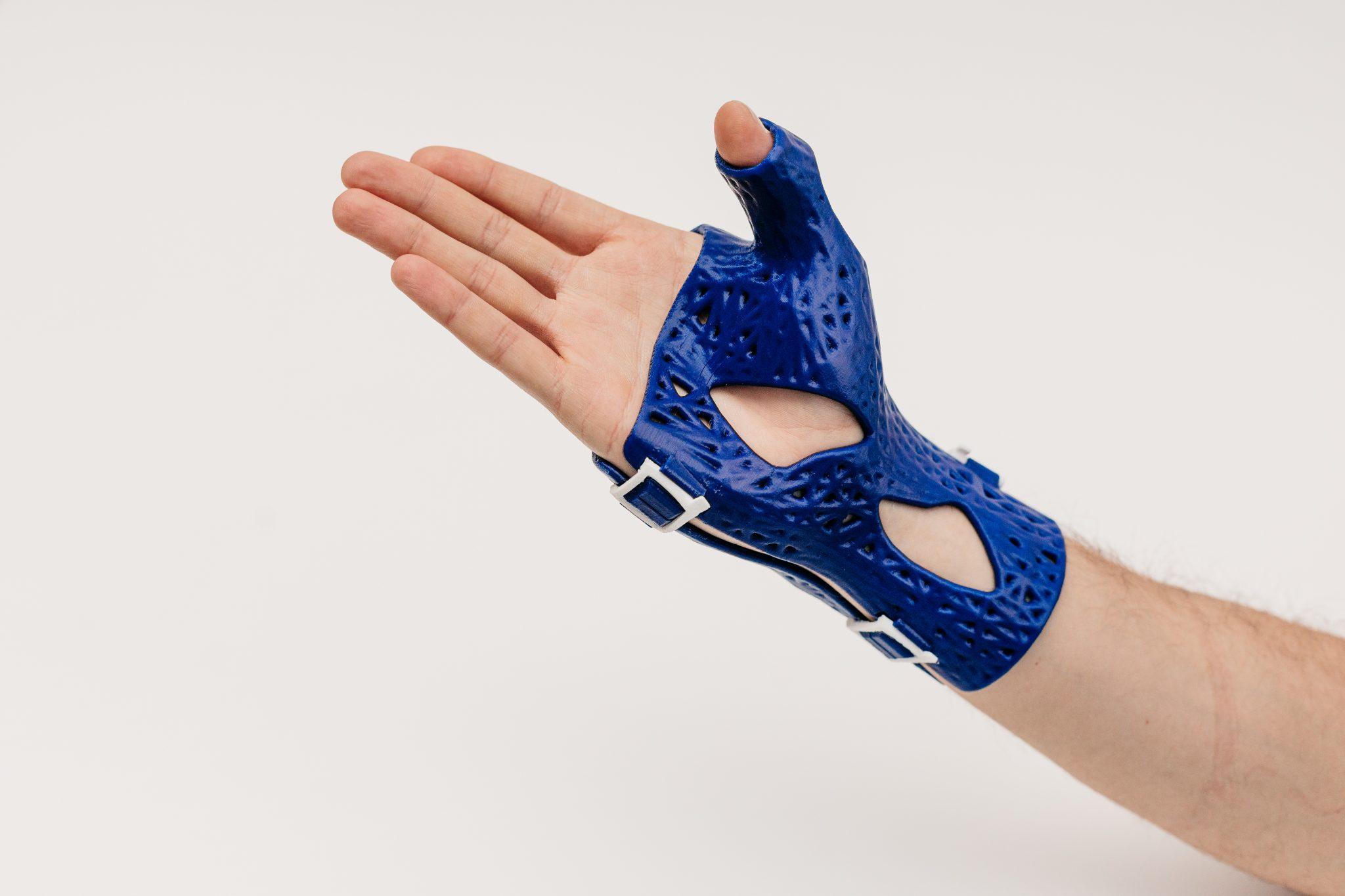 A CastPrint wrist brace. 