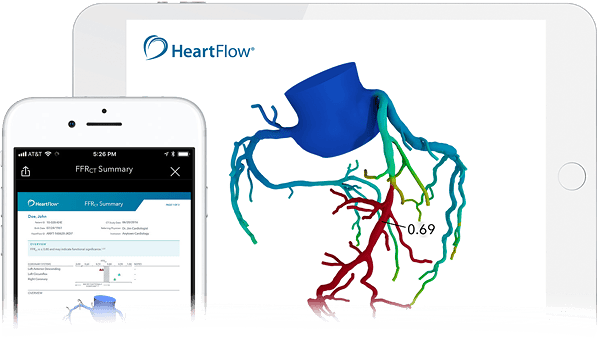 Image of the functionality of healthcare innovation HeartFlow; the mobile dashboard and how you can monitor HeartFlow in the human body.