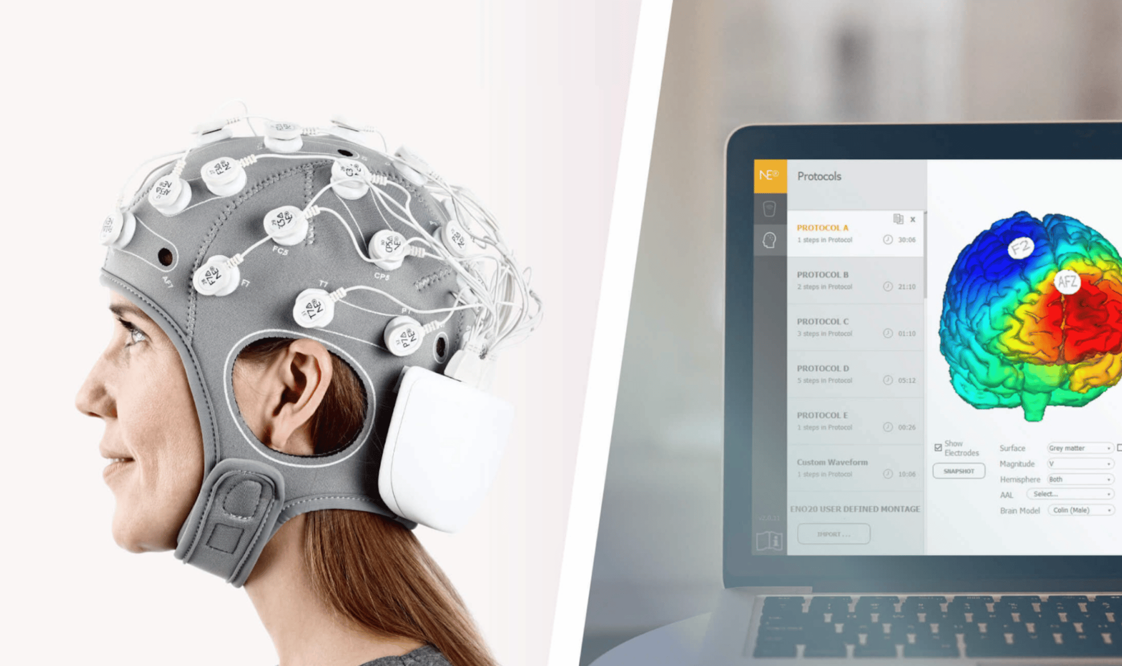 Neuroelectrics