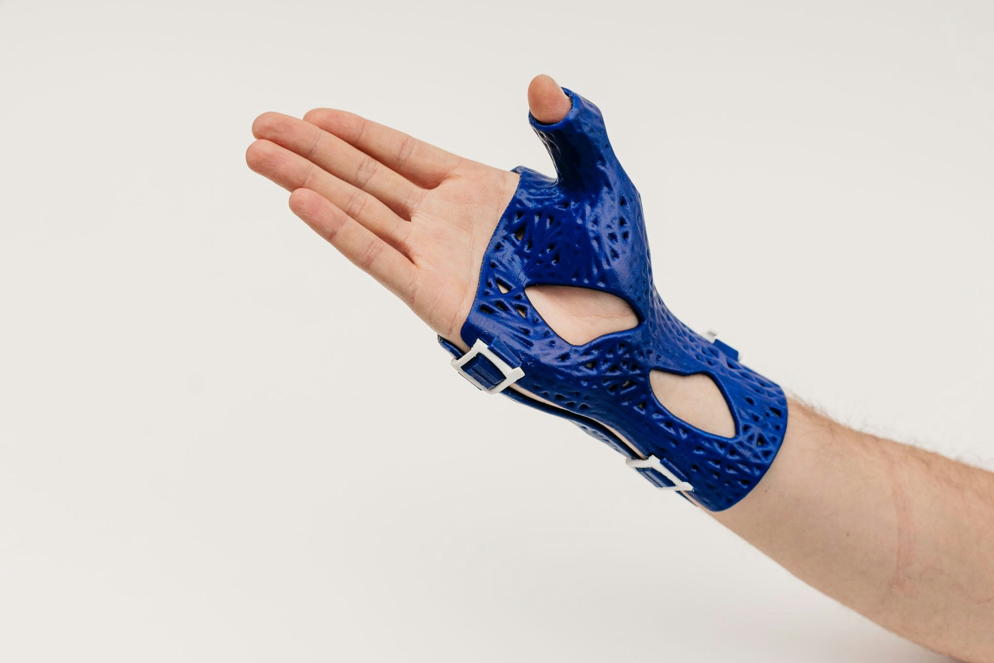 A CastPrint wrist brace. 