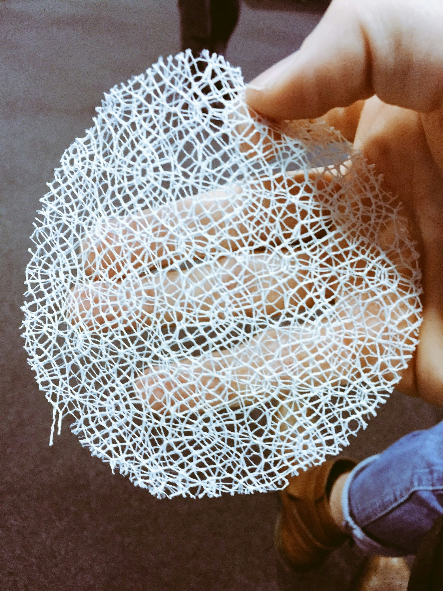 Lattice Medical showcases the intricate forms that can be 3Dprinted.