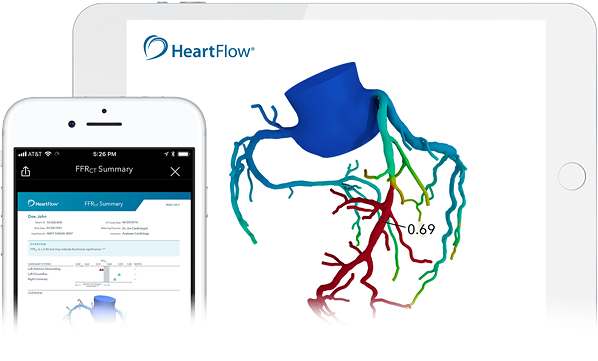 Image of the functionality of healthcare innovation HeartFlow; the mobile dashboard and how you can monitor HeartFlow in the human body.