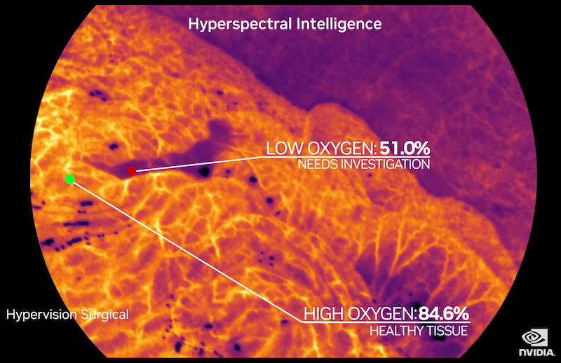 Hypervision's tech showing the oxygen levels of different tissue types