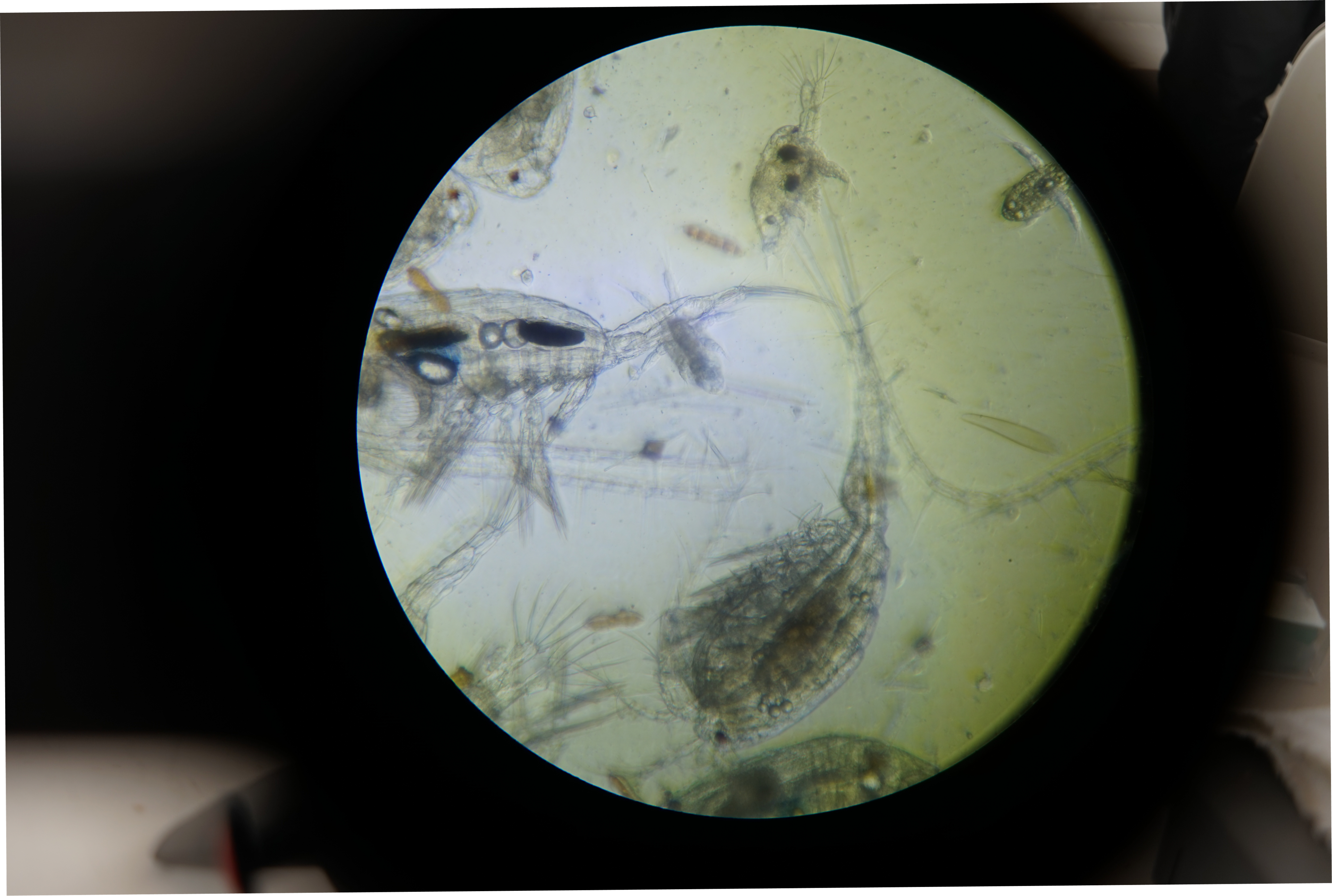 A microscope slide image of Plankton. 