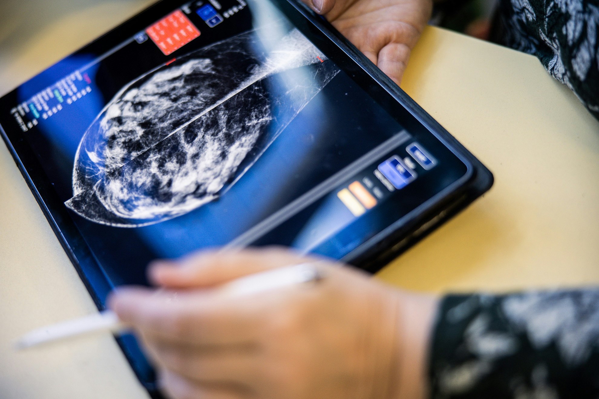 AI could save lives in the NHS – but a lack of adoption pathways are